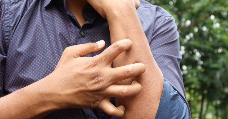 Does Fentanyl Make You Itch? Causes and What It Can Mean