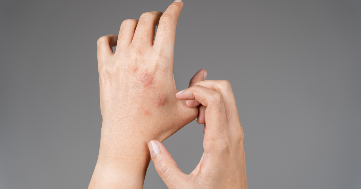 Does Fentanyl Make You Itch? Causes and What It Can Mean