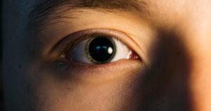 Close up of a human eye showing the iris pupil and surrounding skin